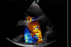 犬の超音波検査写真1