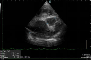 犬の超音波検査写真2