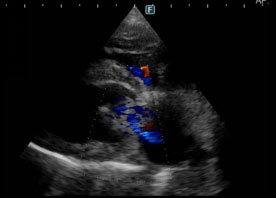 犬の超音波検査写真3